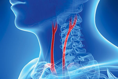 Carotid artery