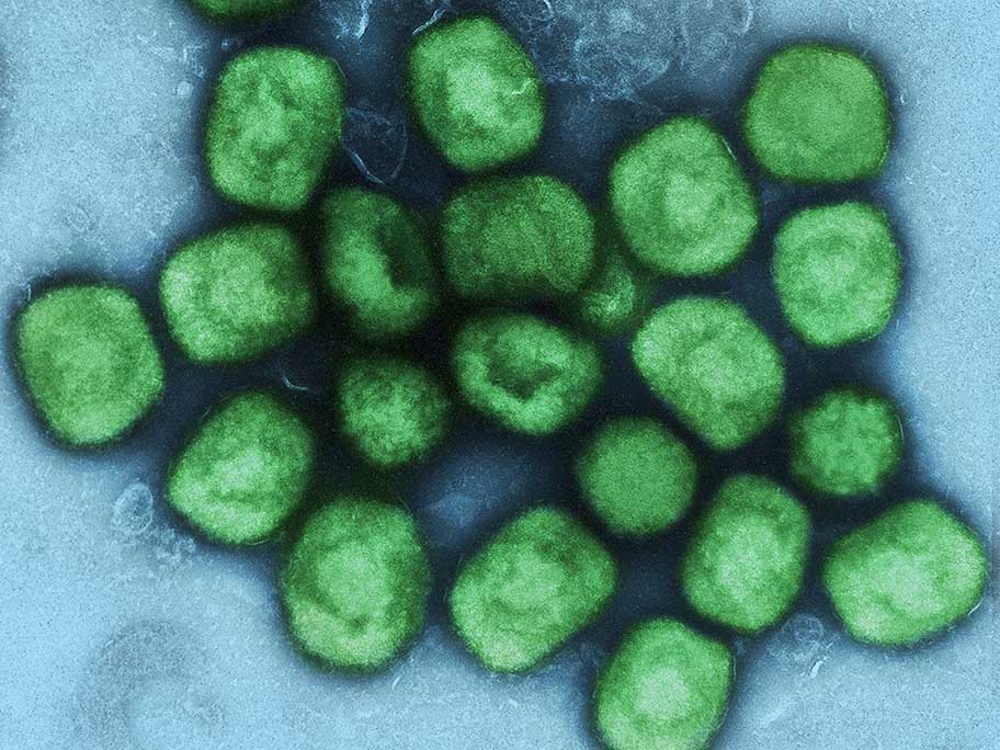 Monkeypox virus